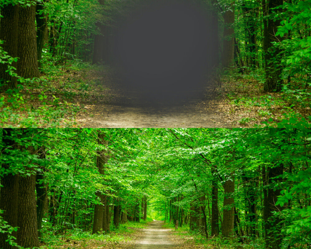 Trockene Makuladegeneration