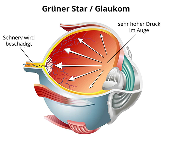Descriptive alt text