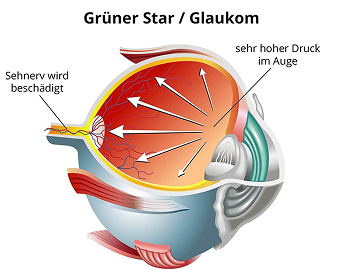 Descriptive alt text